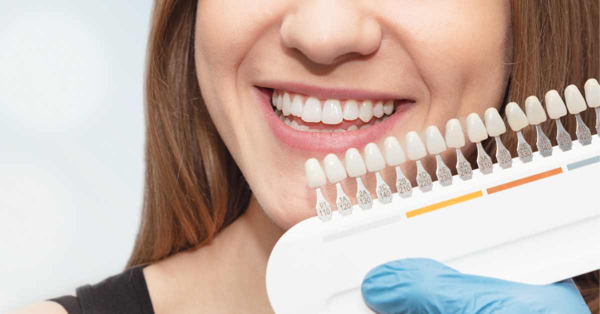 Cosmetic Dentistry Procedures for Replacing Natural Teeth - Huntersville Family and Cosmetic Dentistry