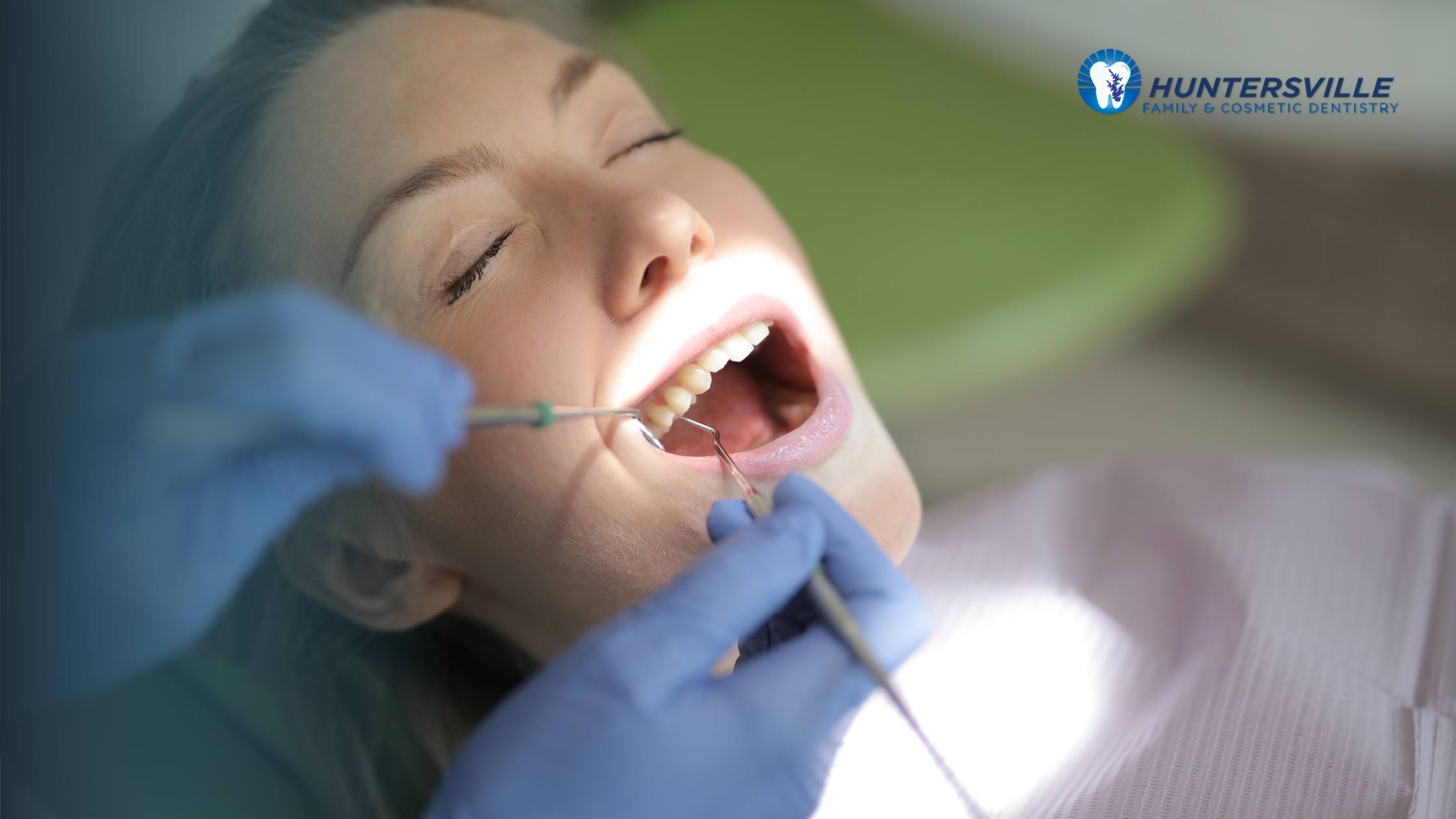 Why Choose Inlays and Onlays Over Traditional Fillings?